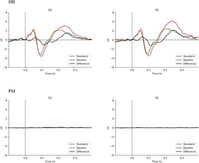 No Detectable Electroencephalographic Activity After Clinical Declaration of Death Among Tibetan Buddhist Meditators in Apparent Tukdam, a Putative Postmortem Meditation State